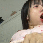 Bảo vệ: Hơi thâm thiệt nha